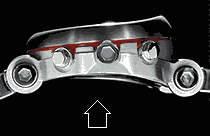 FORMEX patented active suspension